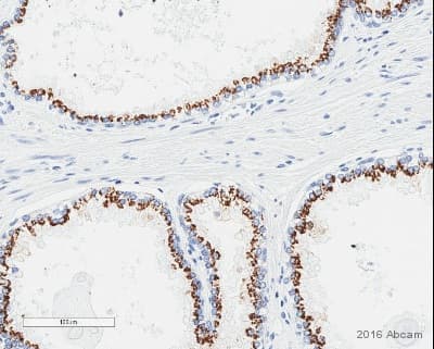 Slc45a3 Antibody Epr47952 Bsa And Azide Free Ab242056  Immunohistochemistry Formalin Pfa Fixed Paraffin Embedded Sections Img109873