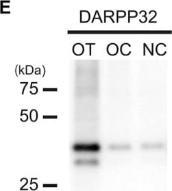 Anti-DARPP32 antibody [EP720Y](AB40801)