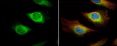 Creatine Kinase B Type Antibody Ab151579  Immunocytochemistry Immunofluorescence Img452074