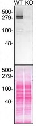 Anti-Huntingtin antibody [EP867Y](AB45169)