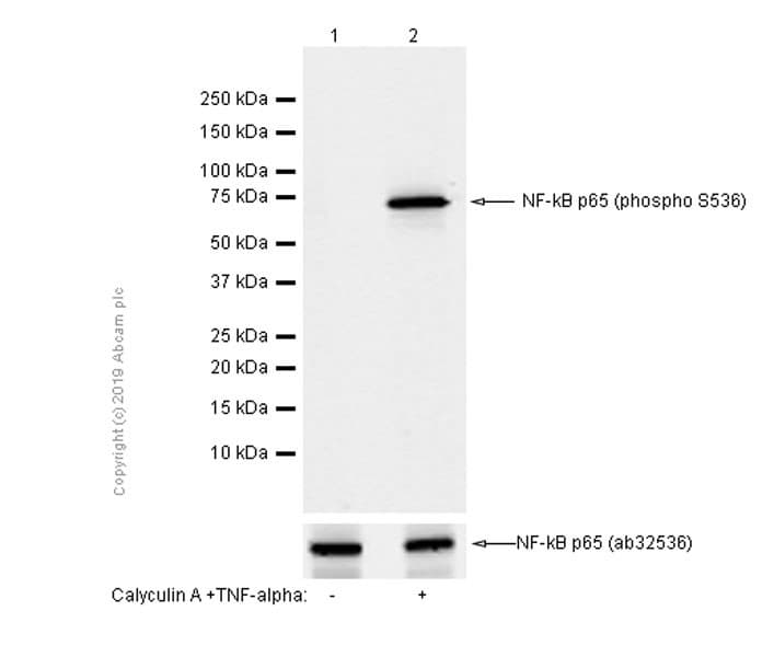Anti-NF-kB p65 (phospho S536) antibody [EP2294Y](AB76302)