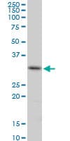 Cenph Antibody Ab88593  Western Blot Img152732