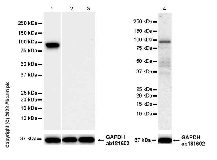 Loxl4 Antibody Epr28300 90 Bsa And Azide Free Ab313798  Western Blot Img419003