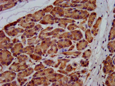 Usp24 Antibody Ab238842  Immunohistochemistry Formalin Pfa Fixed Paraffin Embedded Sections Img123658