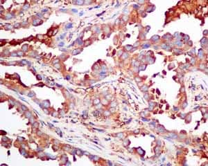 Cap1 Antibody Epr8339b Ab155079  Immunohistochemistry Formalin Pfa Fixed Paraffin Embedded Sections Img120628