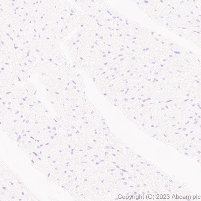 Anti-FOXF1 antibody [EPR27368-79](AB308633)