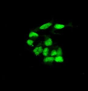 Nuclear Matrix Protein P84 Antibody Epr5661 Bsa And Azide Free Ab248100  Immunocytochemistry Immunofluorescence Img22133