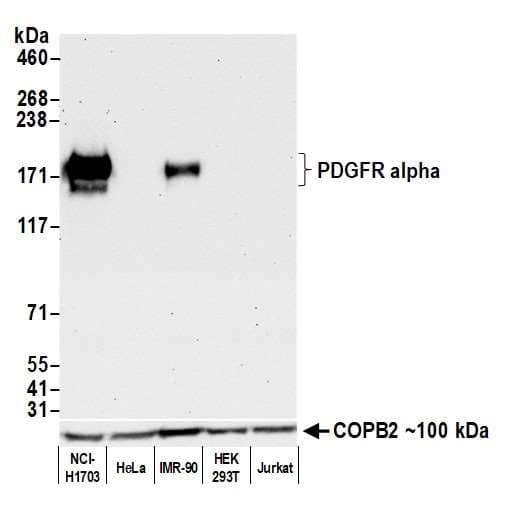 Pdgfr Alpha Antibody Blr128h Bsa Free Ab314105  Western Blot Img420677