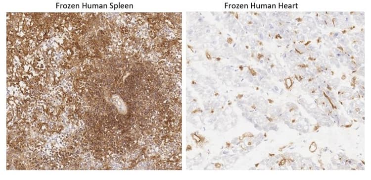 Anti-HLA Class I antibody [W6/32] - BSA and Azide free(AB23755)