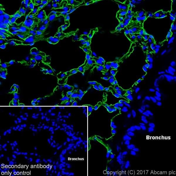 Anti-RAGE antibody [EPR21171](AB216329)