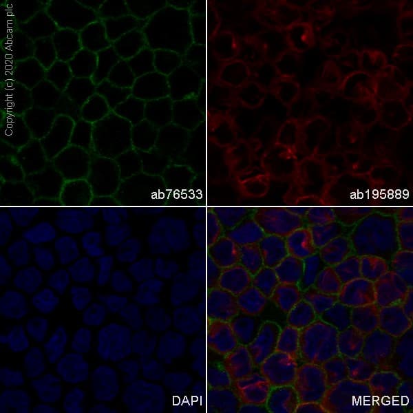 Anti-CD31 antibody [EPR3094](AB76533)