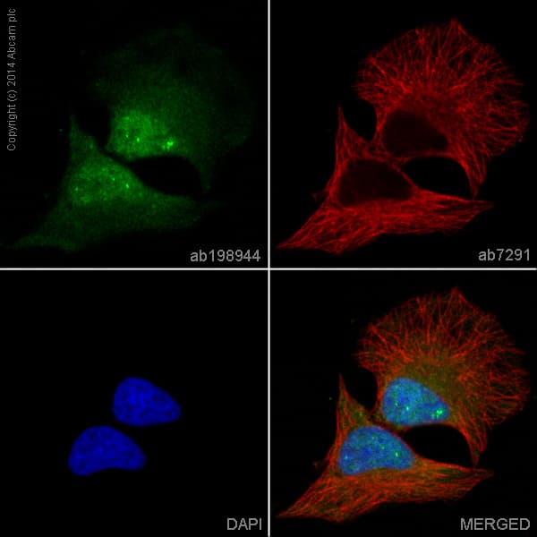 Alexa Fluor 488 Cdk6 Antibody Epr4515 Ab198944  Immunocytochemistry Immunofluorescence Img68864