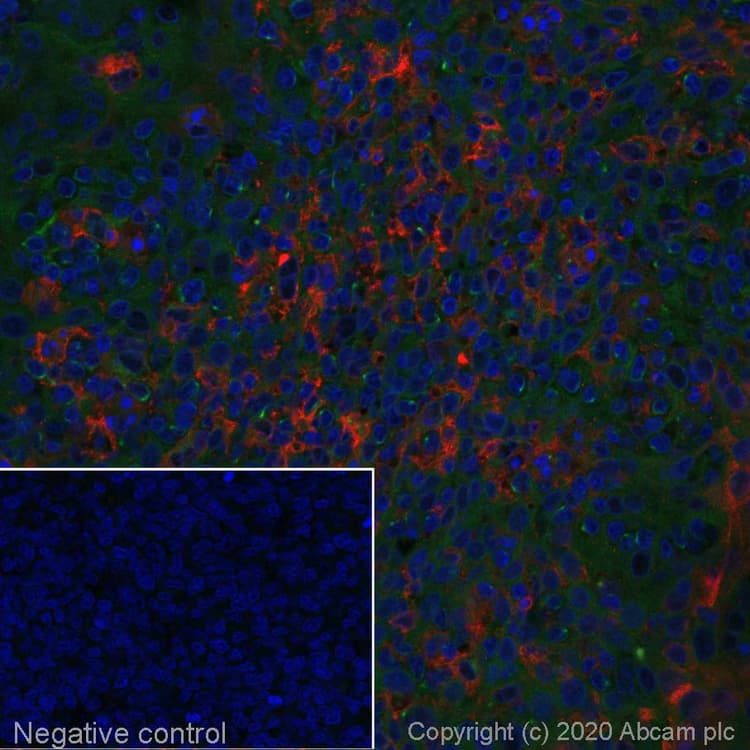 Alexa Fluor 594 Cd11c Antibody Ep1347y Ab277235  Immunohistochemistry Formalin Pfa Fixed Paraffin Embedded Sections Img114958