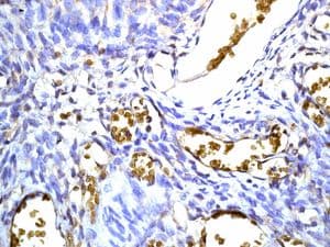 Hemoglobin Subunit Beta Hemoglobin Subunit Delta Antibody Epr8322b Ab131225  Immunohistochemistry Formalin Pfa Fixed Paraffin Embedded Sections Img92023