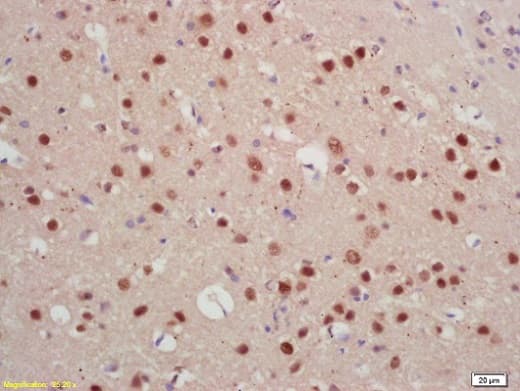 Jarid2 Antibody Ab213679  Immunohistochemistry Formalin Pfa Fixed Paraffin Embedded Sections Img108963