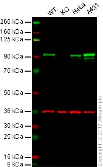 Anti-beta Catenin antibody [E247] - ChIP Grade(AB32572)