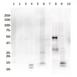 Anti-PAX8 antibody [SP348] - N-terminal(AB227707)