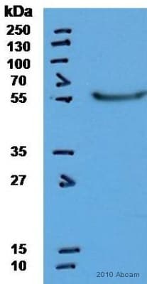 Anti-Cytokeratin 14 antibody [LL002](ab7800)