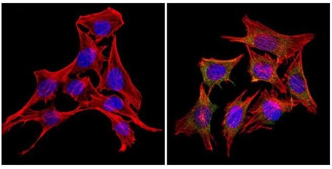 Anti-RAP1A antibody [1D2-1C64](AB175329)