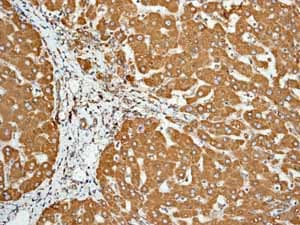 Anti-Calreticulin antibody [EPR3924] - ER Marker(AB92516)