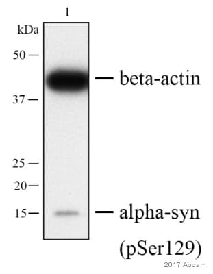 Anti-Alpha-synuclein (phospho S129) antibody [MJF-R13 (8-8)](AB168381)