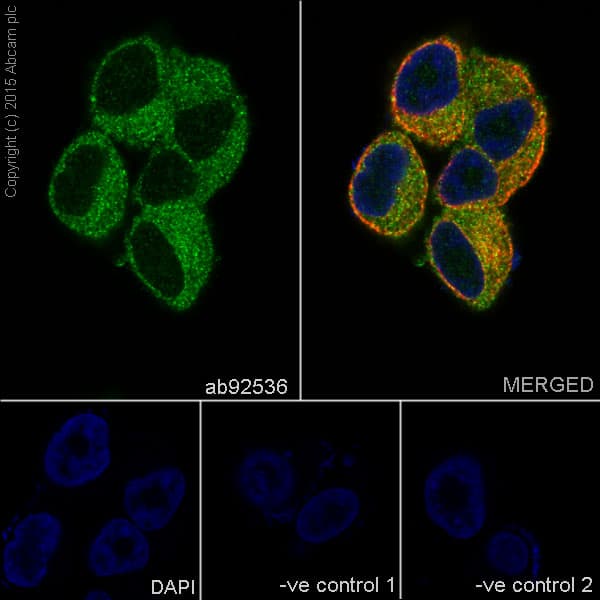 Anti-MMP2 antibody [EPR1184](AB92536)