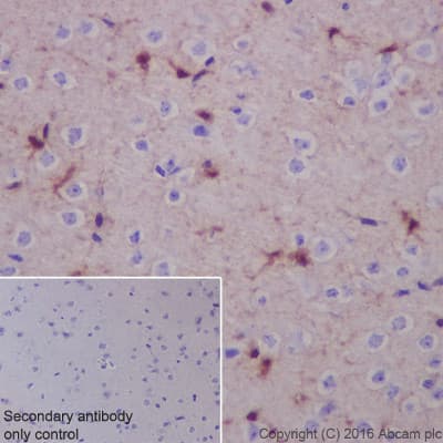 Anti-S100 alpha antibody [EPR5250](AB133519)