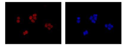 Anti-EXOSC3 antibody [EPR14840(B)] - N-terminal(AB184961)