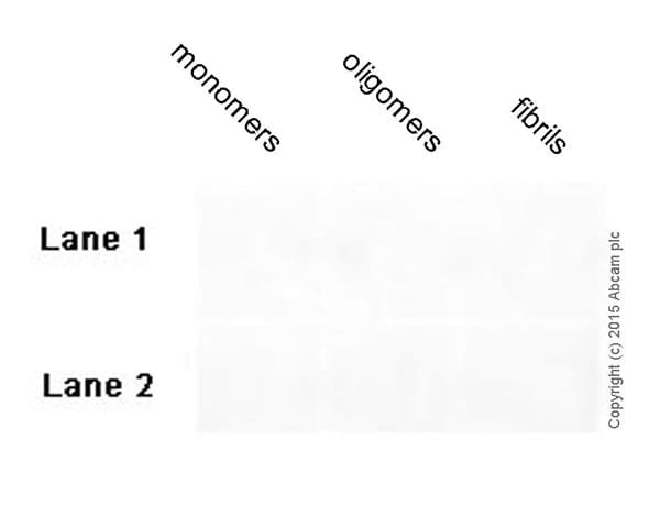 Anti-beta Amyloid 1-42 antibody [mOC64](AB201060)