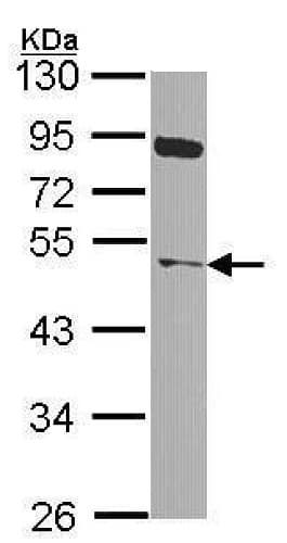 Anti-NEK2 antibody(ab227958)