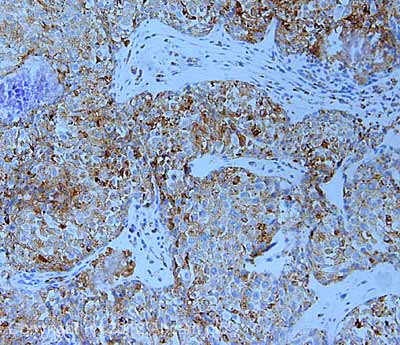 Anti-LAMP2A antibody - Lysosome Marker(AB18528)