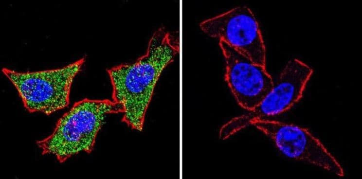 Anti-Hsp70 antibody [5A5](AB2787)