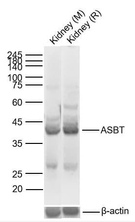 Anti-SLC10A2/ASBT antibody(AB203205)