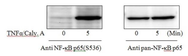 Phospho-NF-kB p65 (S536) ELISA Kit(ab279873)
