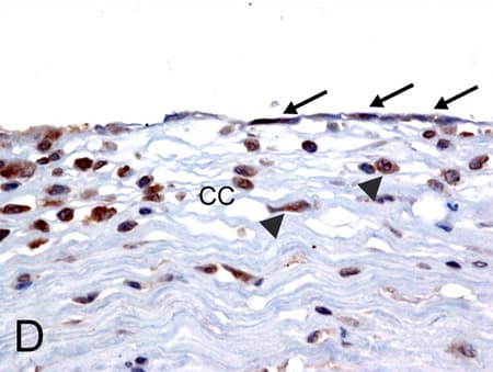 Mica Antibody Ab62540  Immunohistochemistry Formalin Pfa Fixed Paraffin Embedded Sections Img33128