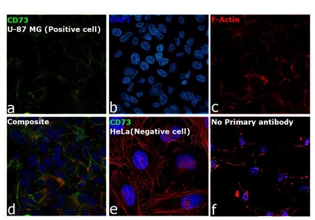 Cd73 Antibody 7g2 Ab54217  Immunocytochemistry Img65591