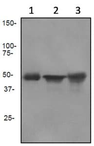 Anti-Cytokeratin 13 antibody [EPR3671](AB92551)