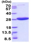 Recombinant human HPRT protein (Active)(ab222951)
