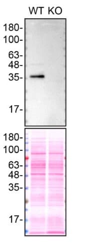 Anti-Apolipoprotein E antibody [EP1374Y](AB52607)