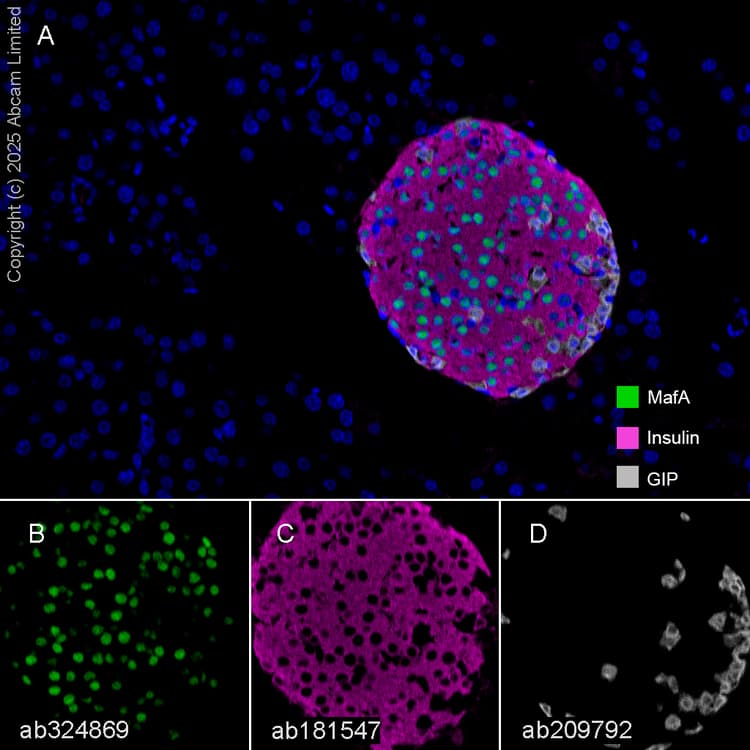 Anti-Insulin antibody [EPR17359](AB181547)