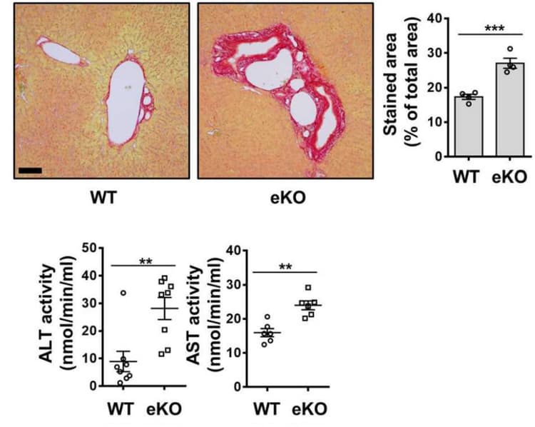 Aspartate Aminotransferase Activity Assay Kit(AB105135)