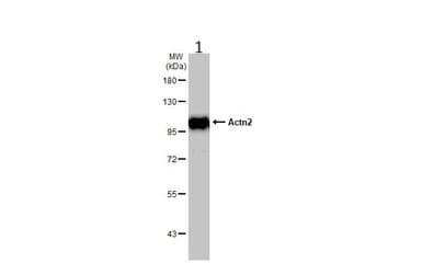 Anti-Sarcomeric Alpha Actinin antibody(AB137346)