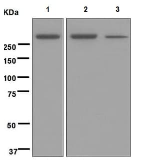 Anti-M6PR (cation independent) antibody [EPR6599](AB124767)