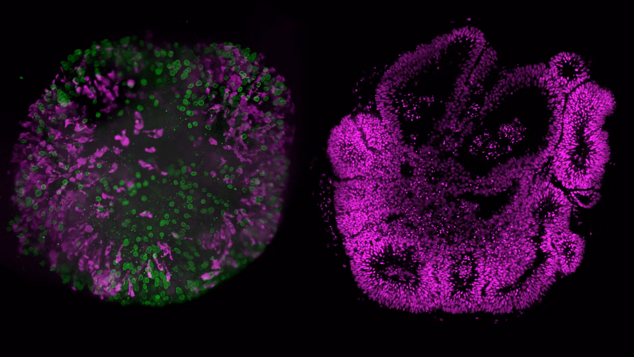 Snap Viventis Deep Organoid Live And Cleared Imaging Composing Kid21774729 1