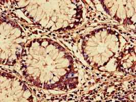 Rars Antibody Ab236788  Immunohistochemistry Formalin Pfa Fixed Paraffin Embedded Sections Img132348