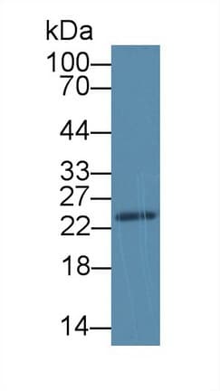 Anti-SDF2L1 antibody(ab231797)