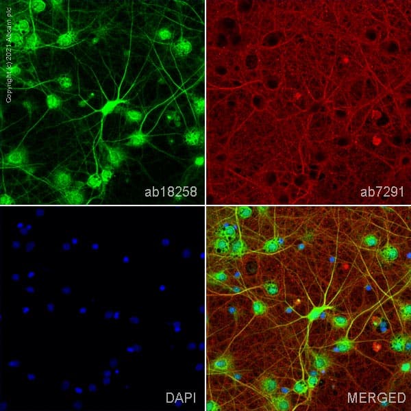 Anti-PSD95 antibody - Synaptic Marker(AB18258)