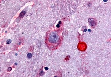 Delta Opioid Receptor Antibody Ab219059  Immunohistochemistry Formalin Pfa Fixed Paraffin Embedded Sections Img119832