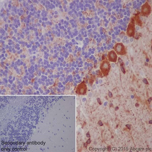 Anti-GAD65 + GAD67 antibody [EPR19366](AB183999)