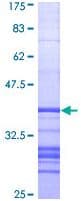 Recombinant Human Alkaline Phosphatase, Tissue Non-Specific protein(AB114267)